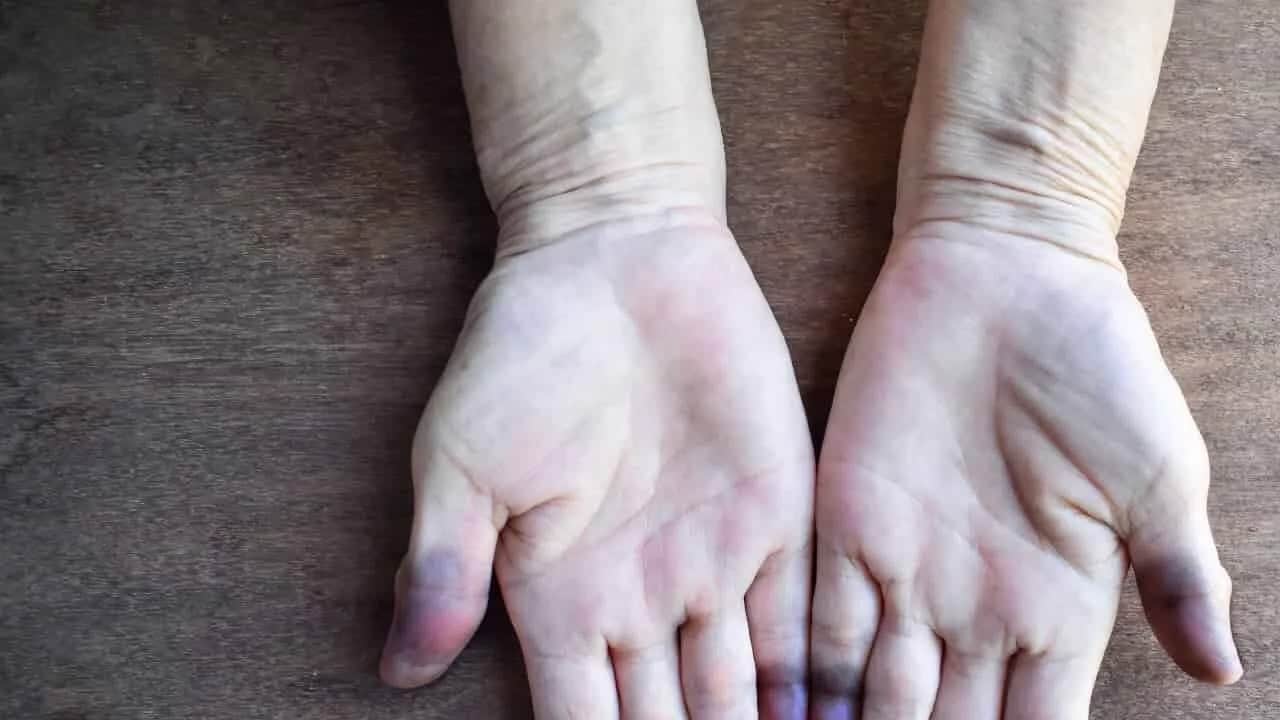 Foto - El ve ayakları beyazlatan yöntemler yardımcı oluyor sürün: Bölgeye uygulayın! Onlarla banyo yapın