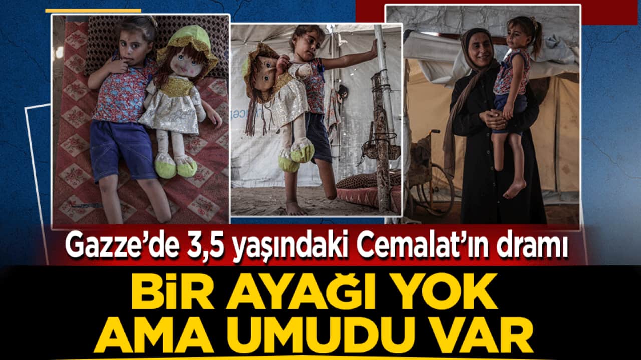 Gazze’de 3,5 yaşındaki Cemalat’ın dramı! Bir ayağı yok ama umumdu var 