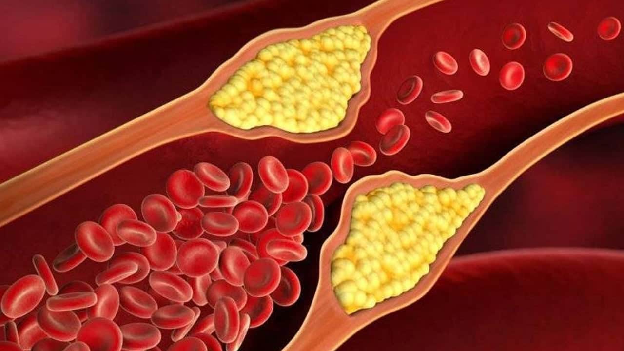 Foto - İnceleme sonrası ortaya çıktı: Yiyenin kolesterolü pat diye düşüyor! Bu bitki (LDL) seviyelerinde dengelemeye yardımcı