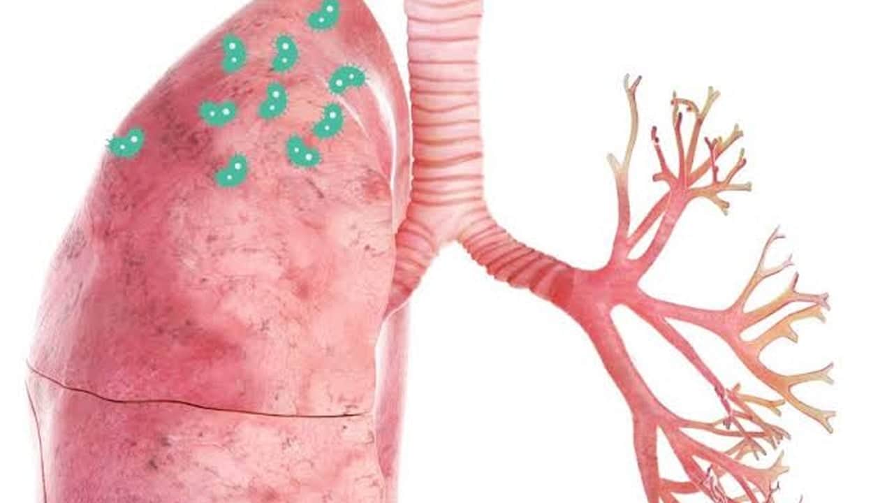 Foto - Kalp-damar hastalığı olanlar erken tanı ve düzenli check-up hayati önemde! Uzmanın o mesajı...
