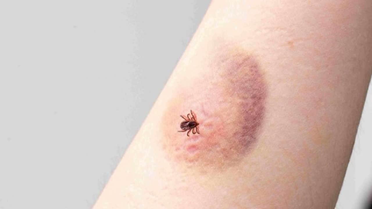 Foto - Kene ısırığı sonrası bu görüntü varsa dikkat