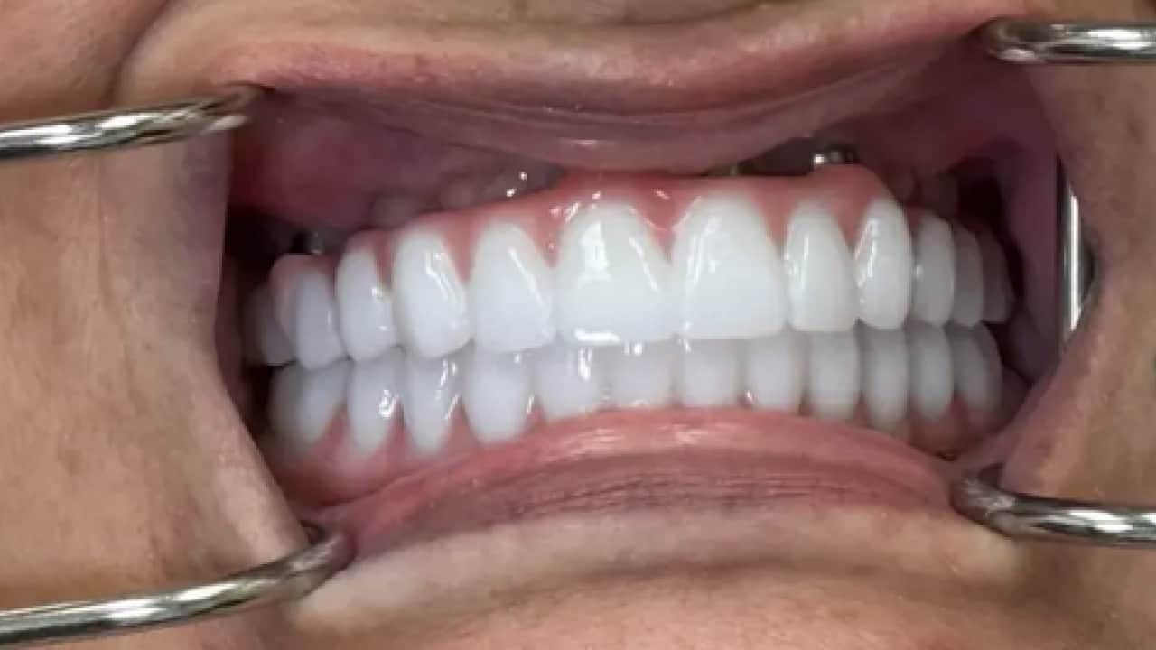 Foto - Ketozis nedir? Ağzınızdaki metal tadı bakın neyin habercisi...