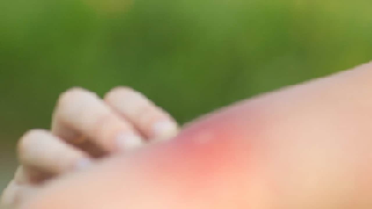 Foto - Küçük bir kavanoza elma sirkesi koyun ve... Sinekleri yok etmenin formülü... Korkudan ödleri kopacak