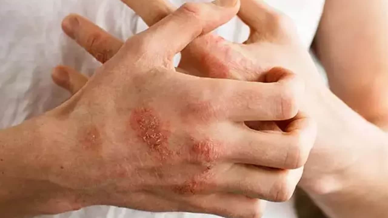 Kuru dutun faydaları: En güçlü kaynak, kansere düşman