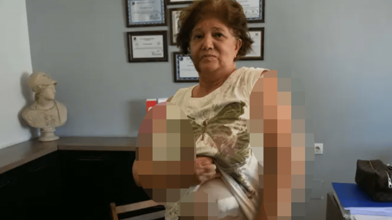 Foto - Kuşadası'nda akılalmaz skandal: Magandalar ev sahiplerini komalık etti