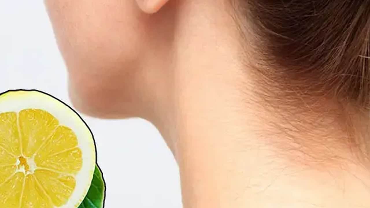 Foto - Limon kabuğunu çöpe atmak yerine yüzünüze sürün: Sürünce lekelerden eser kalmıyor! Yıllarca sürüldü, sınandı