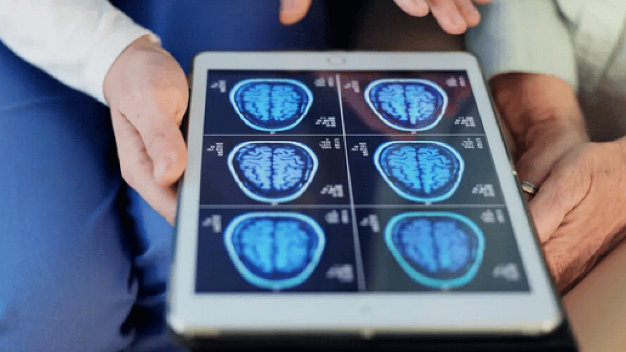 Foto - Deniz ürünleri hafızayı yeniliyor! Öğrenme, oryantasyon ve kişilik... Alzheimerla savaşan besinler