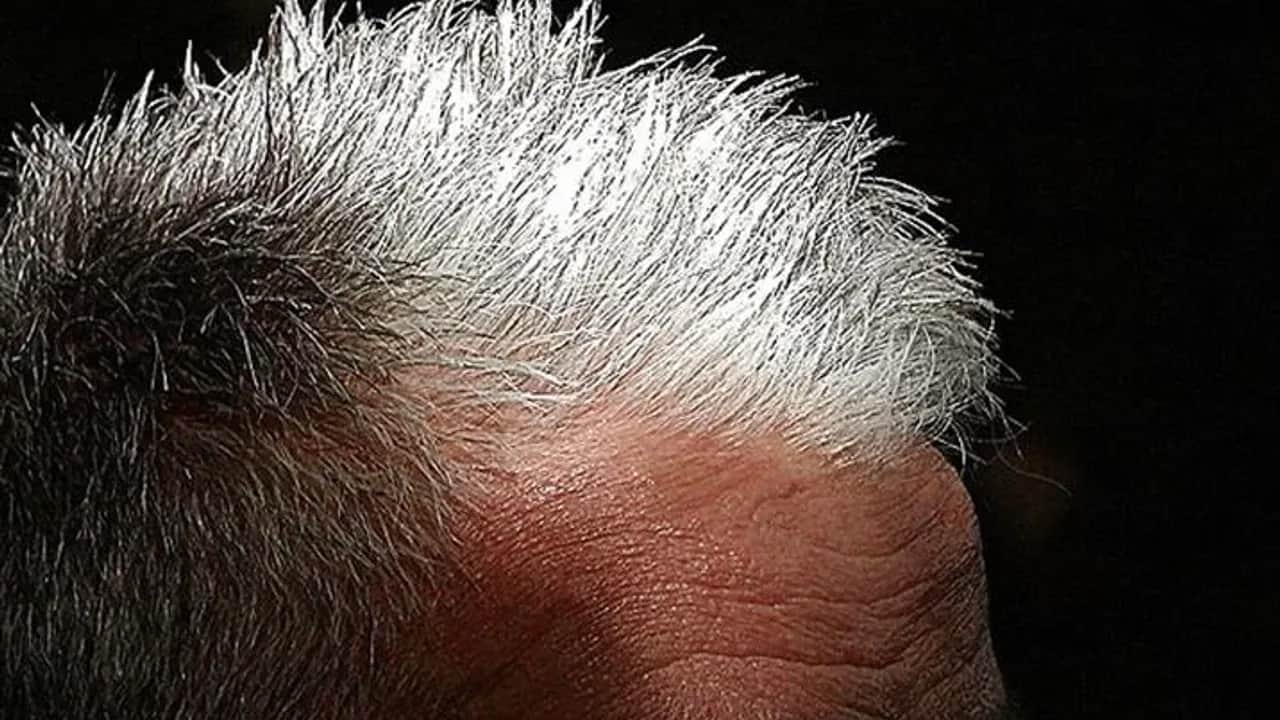 Foto - Saç beyazlamasına karşı B-12 besleyici, dengeli tarif... Dikkat: 5 dakikada yapacak, beyaz saç artık kalmayacak