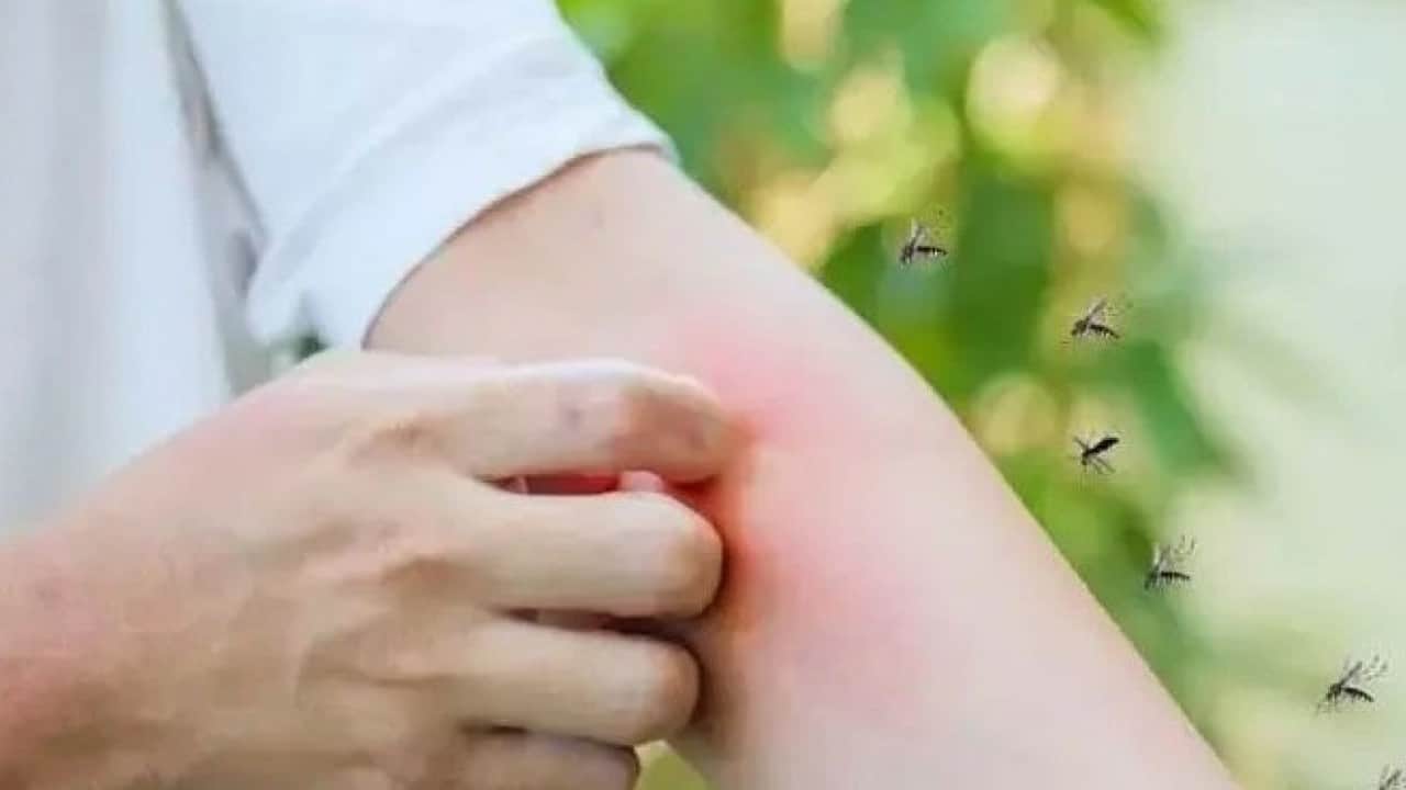Foto - Sivrisineklerin bazı insanları daha çok ısırmasının nedeni ortaya çıktı