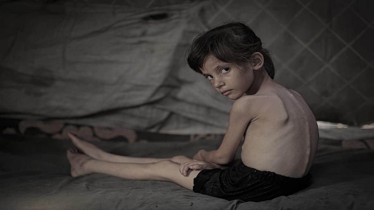 Foto - Yılın acı fotoğrafları! Gazze’deki sistematik silah açlık