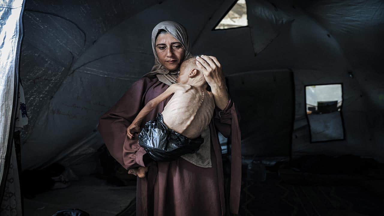 Foto - Yılın acı fotoğrafları! Gazze’deki sistematik silah açlık