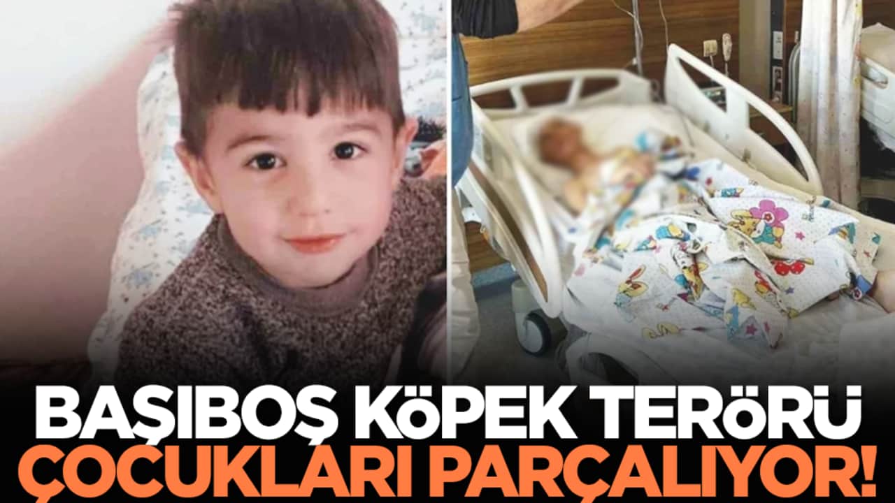 Başıboş köpek terörü çocukları parçalıyor!