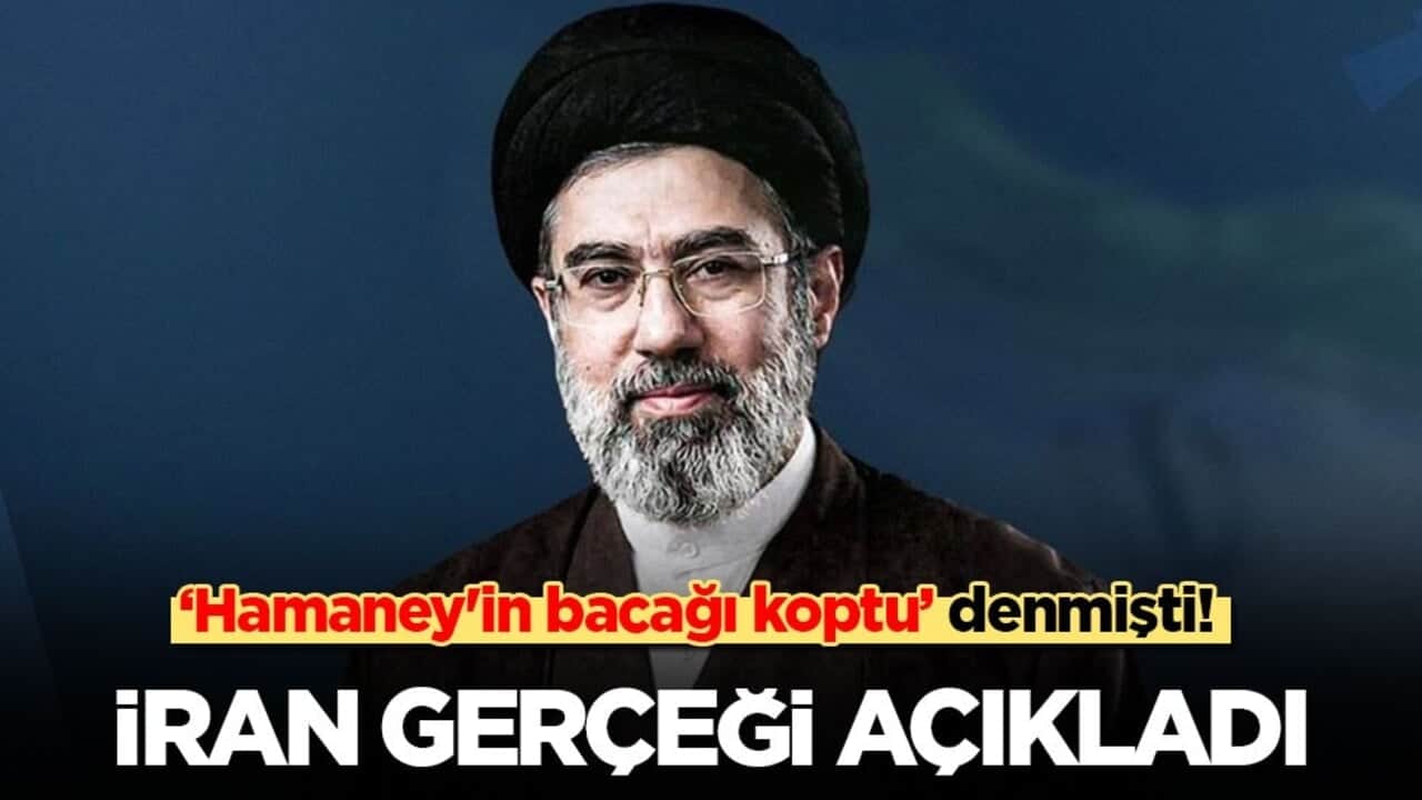 ‘Hamaney'in bacağı koptu’ denmişti! İran: Kafa, yüz ve bacaklarından yaralandı