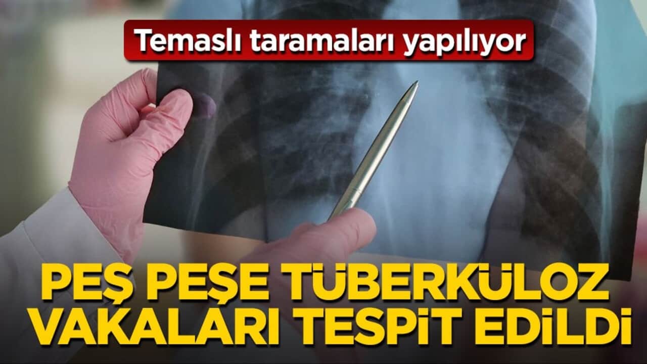 Temaslı taramaları yapılıyor! Peş peşe tüberküloz vakaları tespit edildi