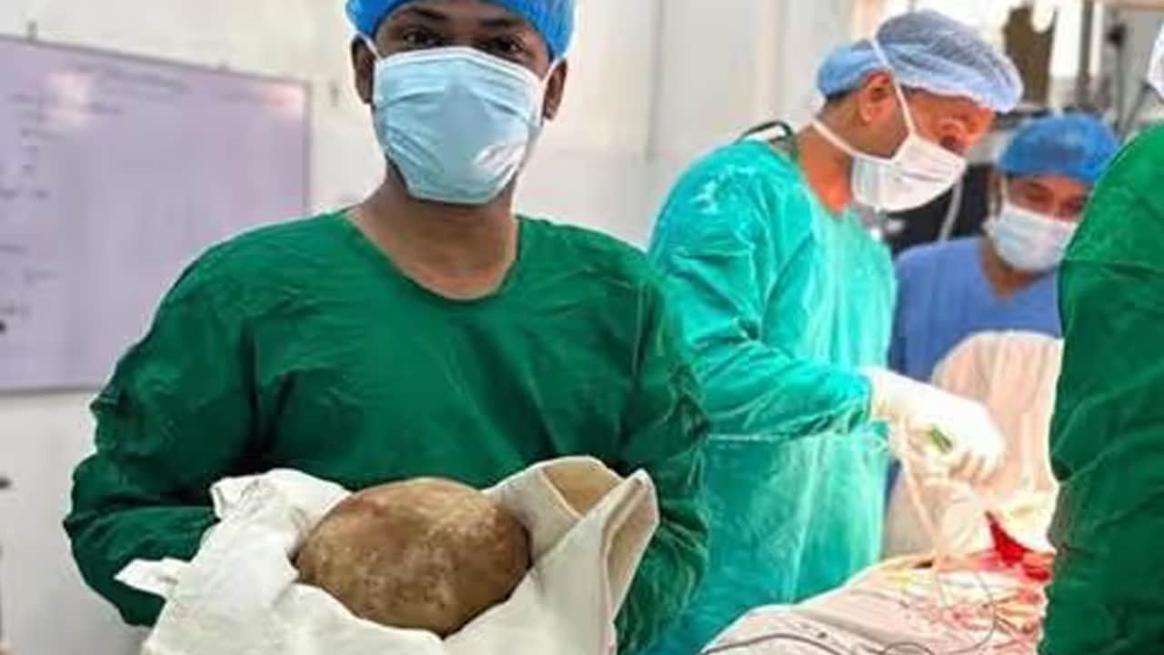 Akılalmaz ameliyat: Hastadan 3 kiloluk tek parça taş çıkarıldı!