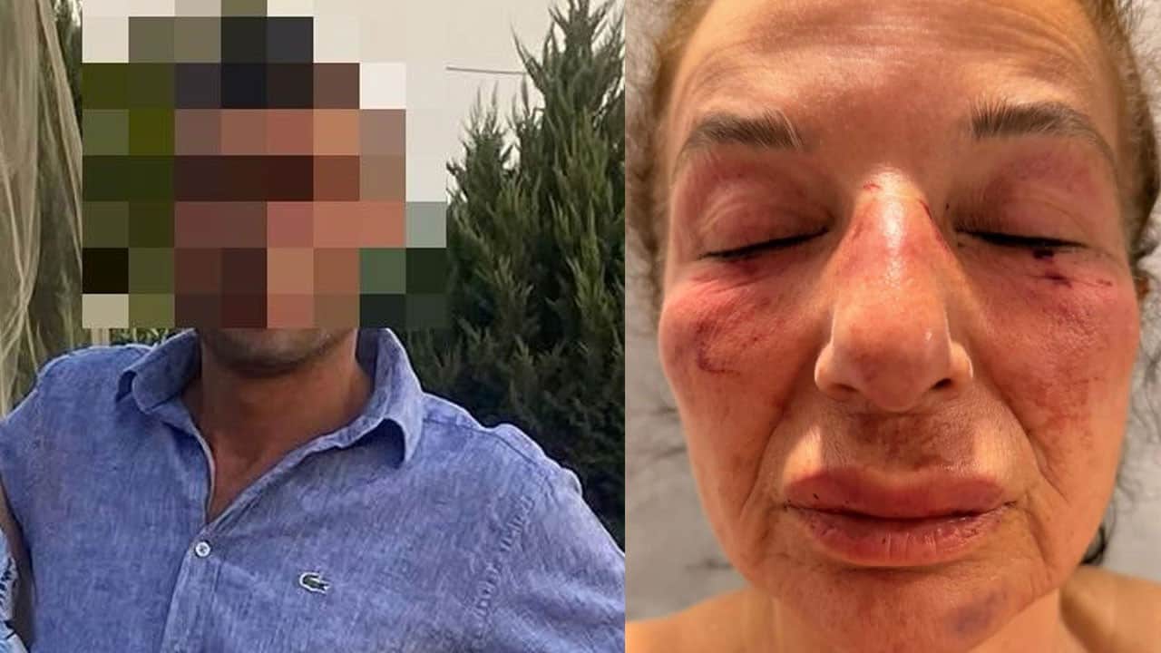 CHP’li belediye çalışanından eczacı kadına hayvanlı tuzak!