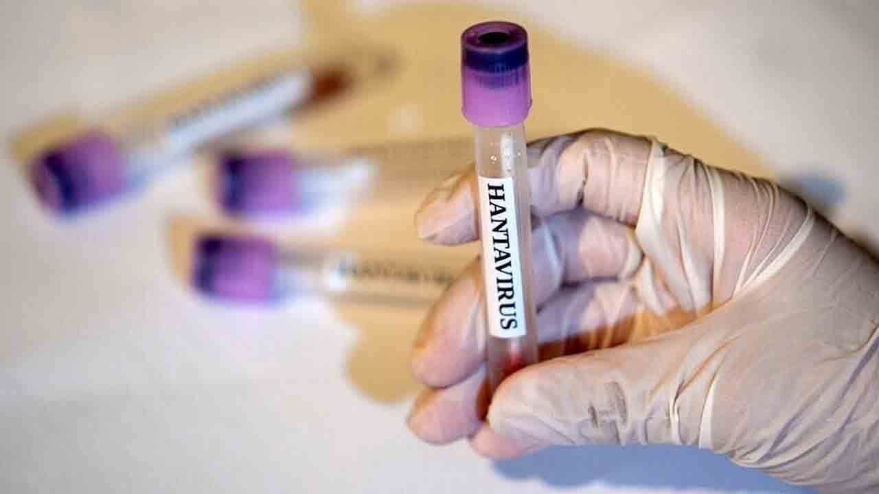 İngiltere’de bir hantavirüs şüphesi daha