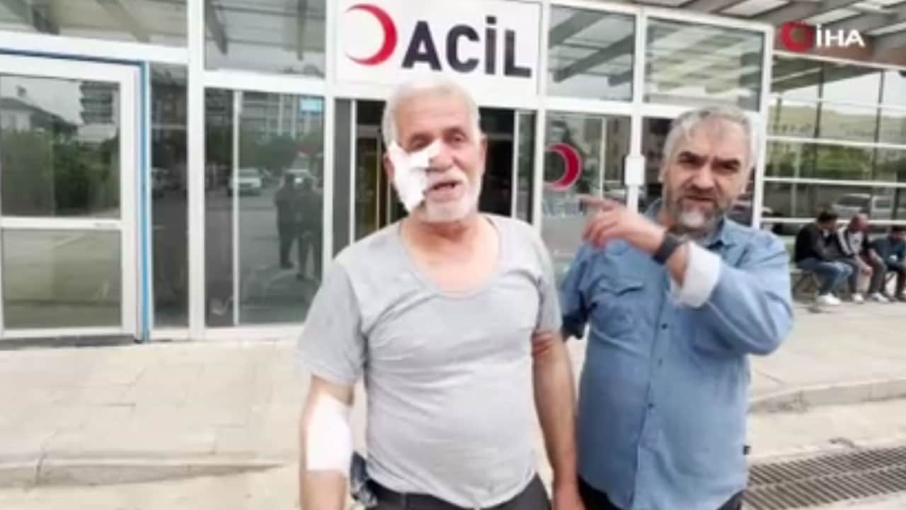 Minibüs beklerken dehşeti yaşadı! Sahipsiz köpek yüzünü ısırdı