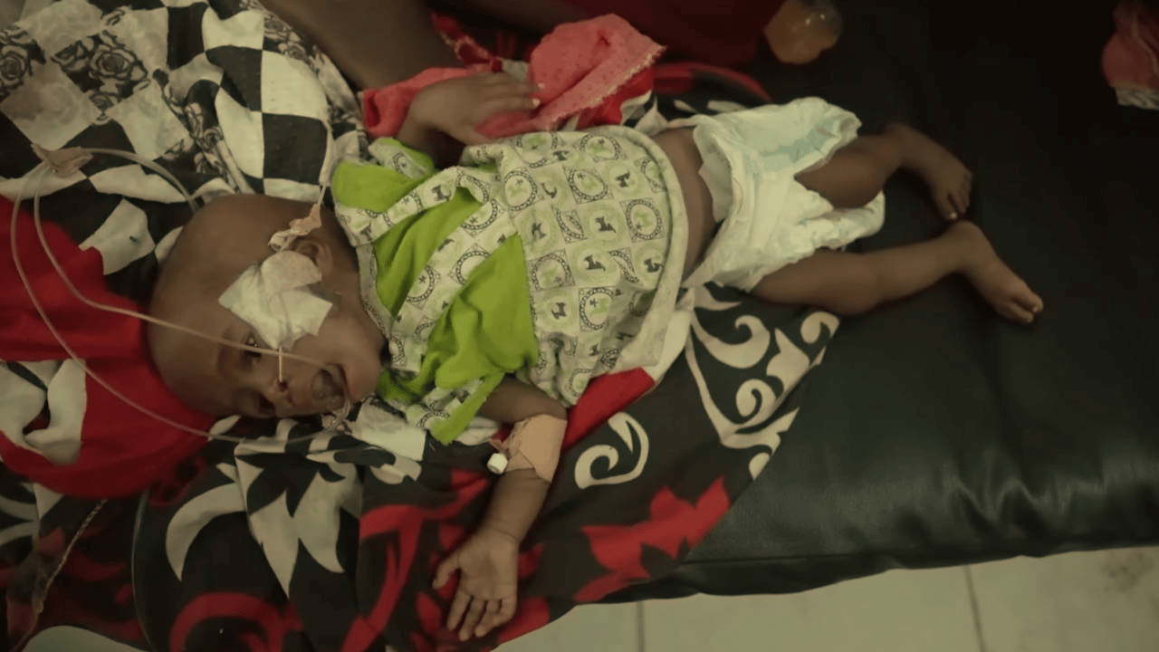 Sudan'da 13 milyon kişi savaş nedeniyle yerinden edildi
