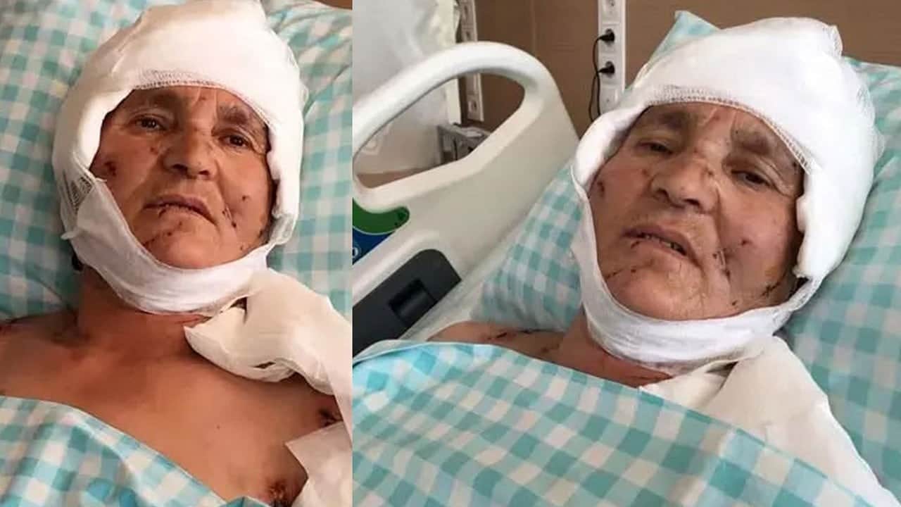 Yaşlı kadının kulak ve kolları parçalanmıştı! Vahşi köpek sahiplerine rekor tazminat cezası