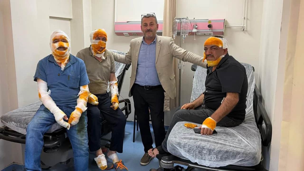 Yemek yapmak için tüpü açtı, mutfak patladı!