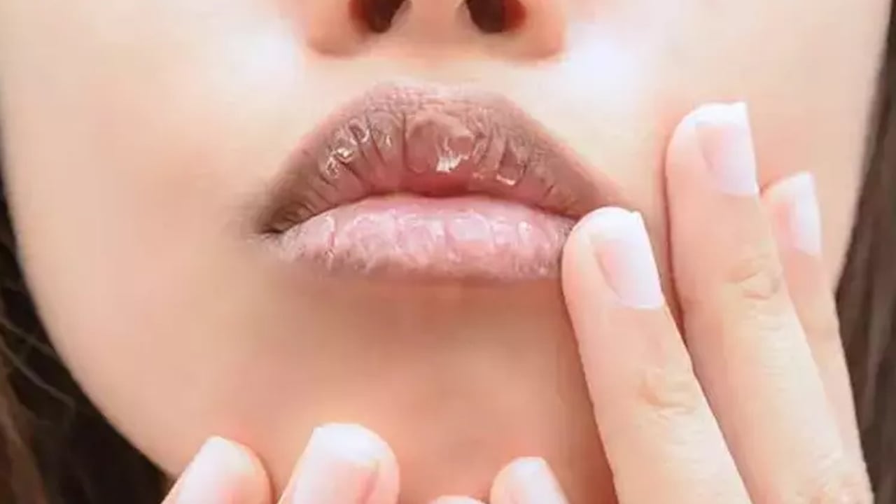 Foto - 1 gecede dudak kuruluğuna çözüm! Yapmayan tam manasıyla bin pişman: B1,B2 ve B3 sorunu olabilir
