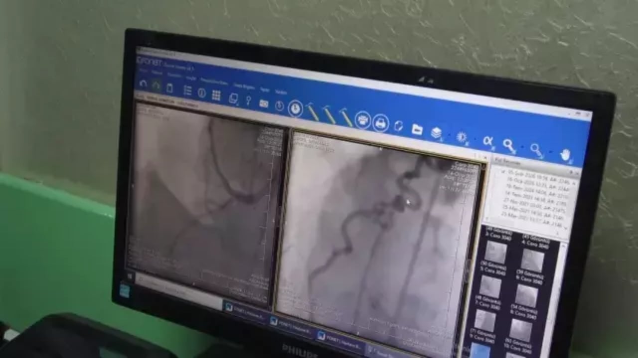 Foto - 100 binde bir görülüyor! Göğüs yanması diye gitti, hayatının şokunu yaşadı