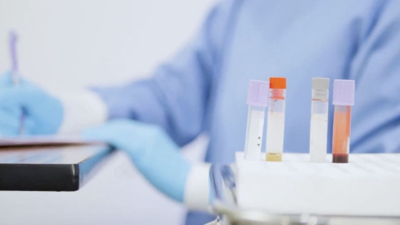 Foto - 15 Temmuz gecesi işlenen cinayet yıllar sonra çözüldü! JASAT kıskıvrak yakaladı