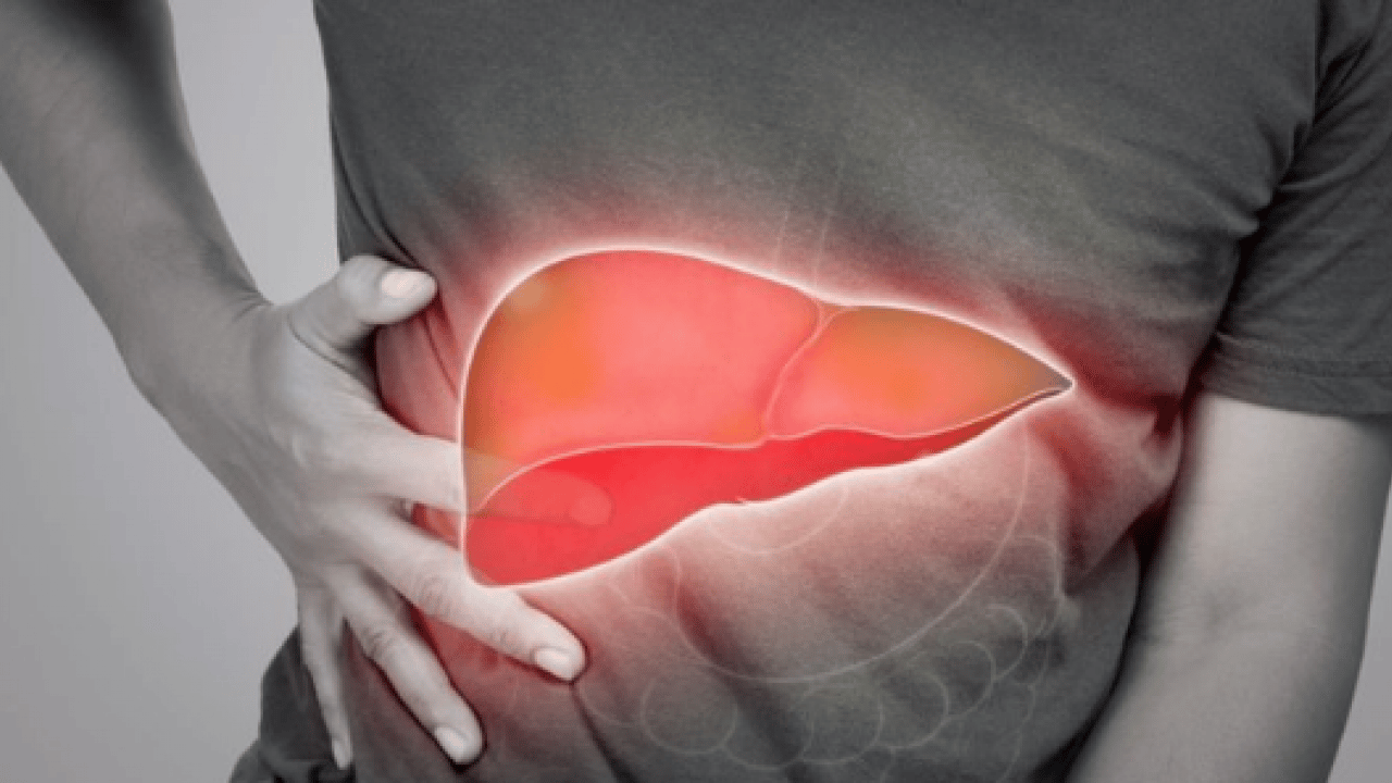 Foto - 2050 yılında yaklaşık 1.8 milyar kişi... Karaciğer yağlanması her 6 kişiden birini etkiliyor