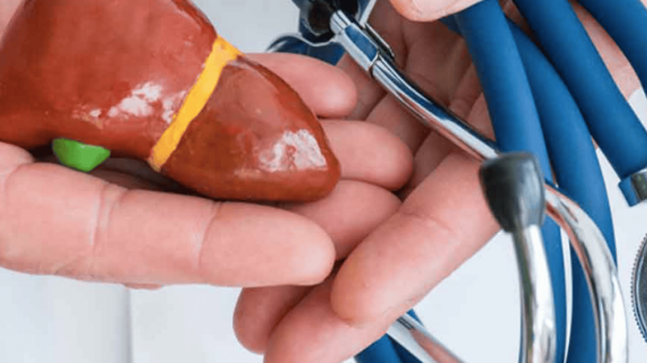 Foto - 2050 yılında yaklaşık 1.8 milyar kişi... Karaciğer yağlanması her 6 kişiden birini etkiliyor