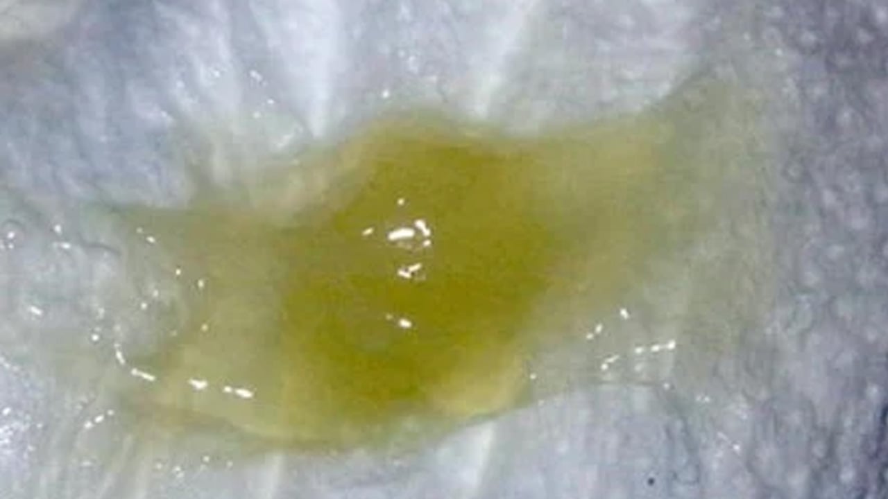 Foto - 24 Saatte gripten nasıl kurtulursunuz? Kekiği her sabah aç karnına içerseniz! Bakın kat kat daha faydalı