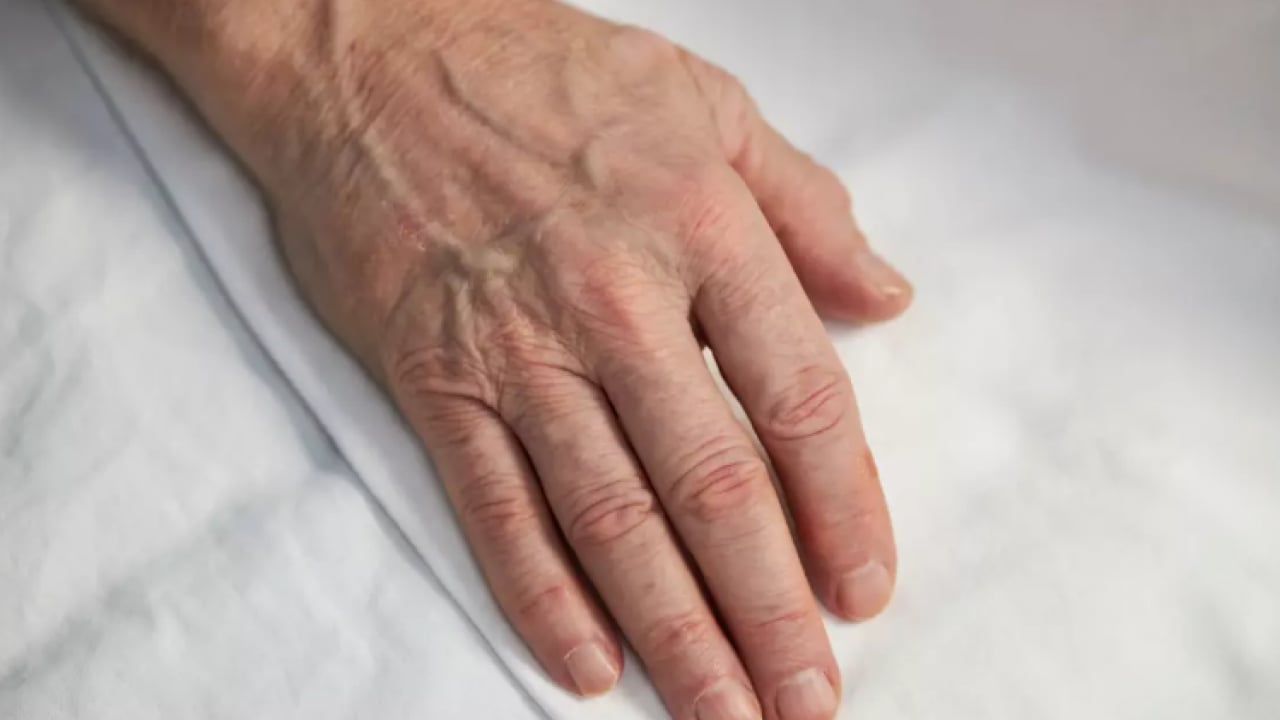 Foto - 25 yaşında 60 gibi görünüyor: İşte damarların belirgin olmasının 6 nedeni!