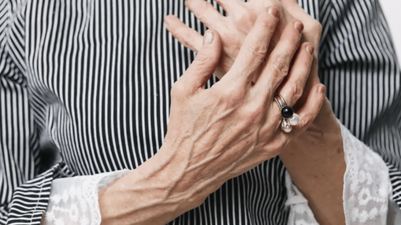 25 yaşında 60 gibi görünüyor: İşte damarların belirgin olmasının 6 nedeni!