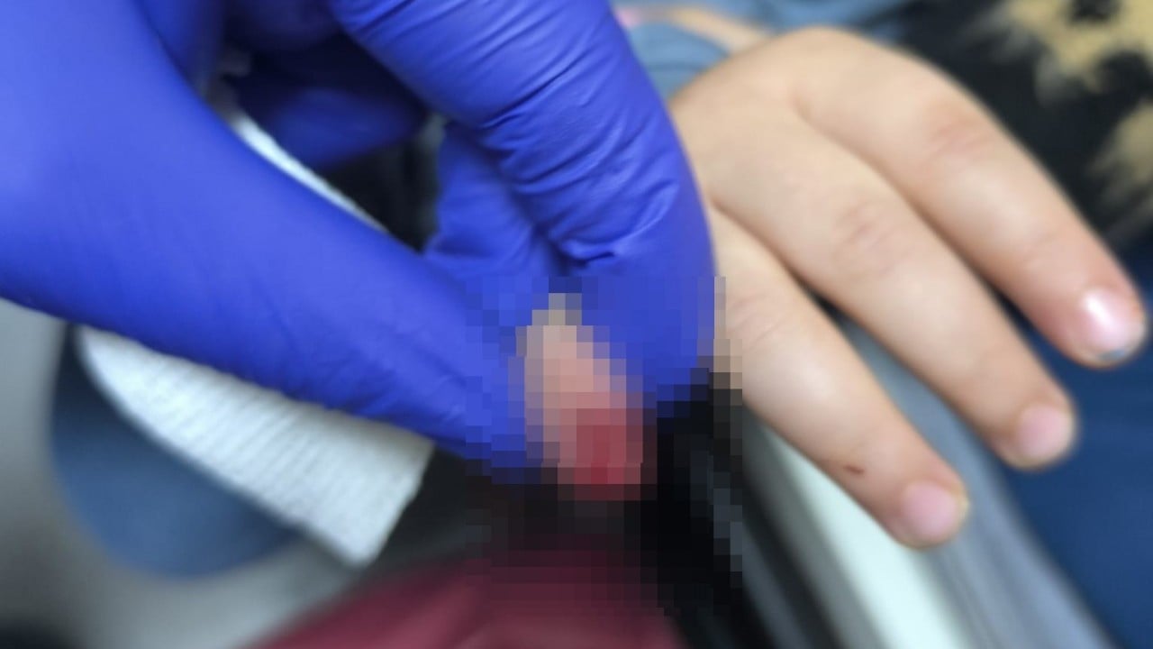 Foto - 3 yaşındaki çocuk hastanelik oldu: Yürüyen merdivende korkunç olay!