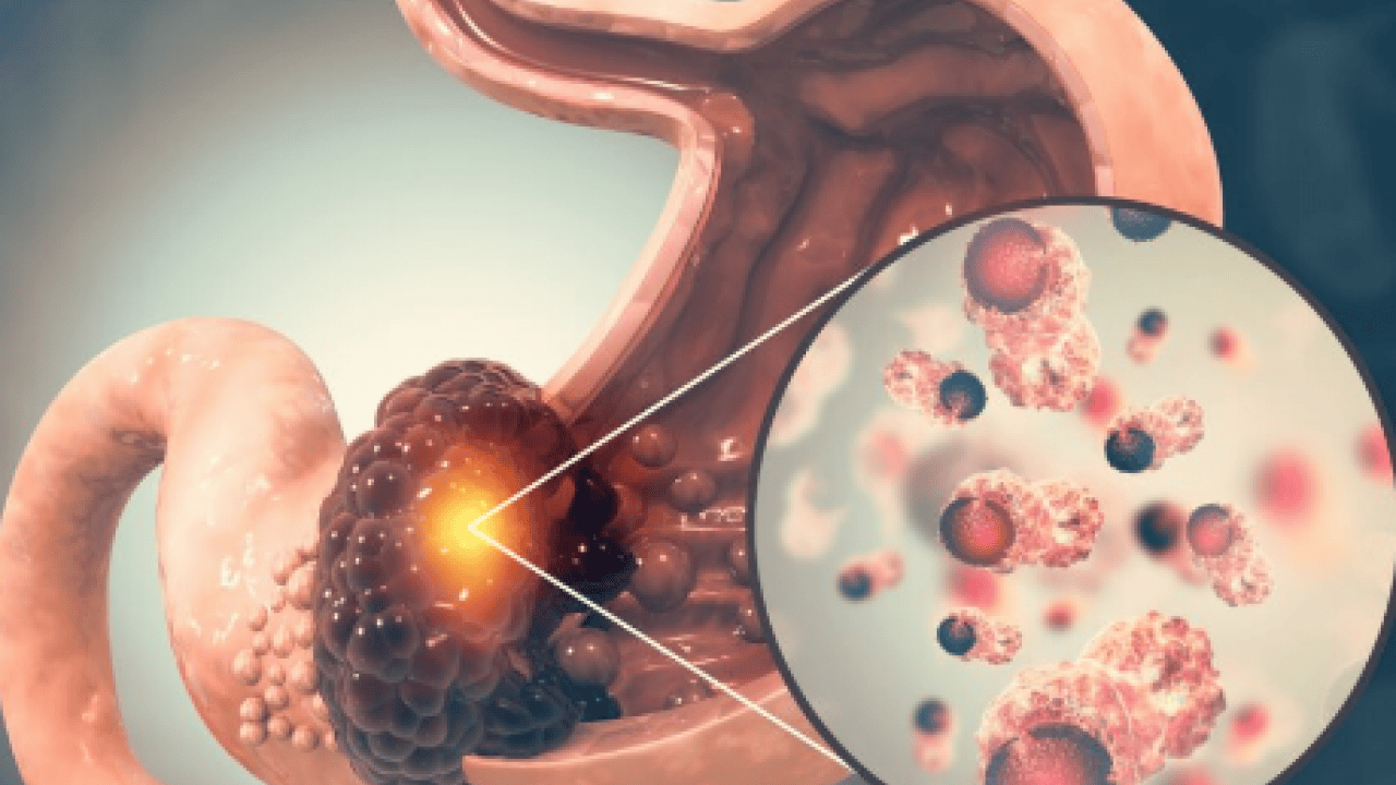 40 yaş üzerindeyseniz bu uyarılara kulağınızı tıkamayın! Genel cerrahi uzmanı açıkladı