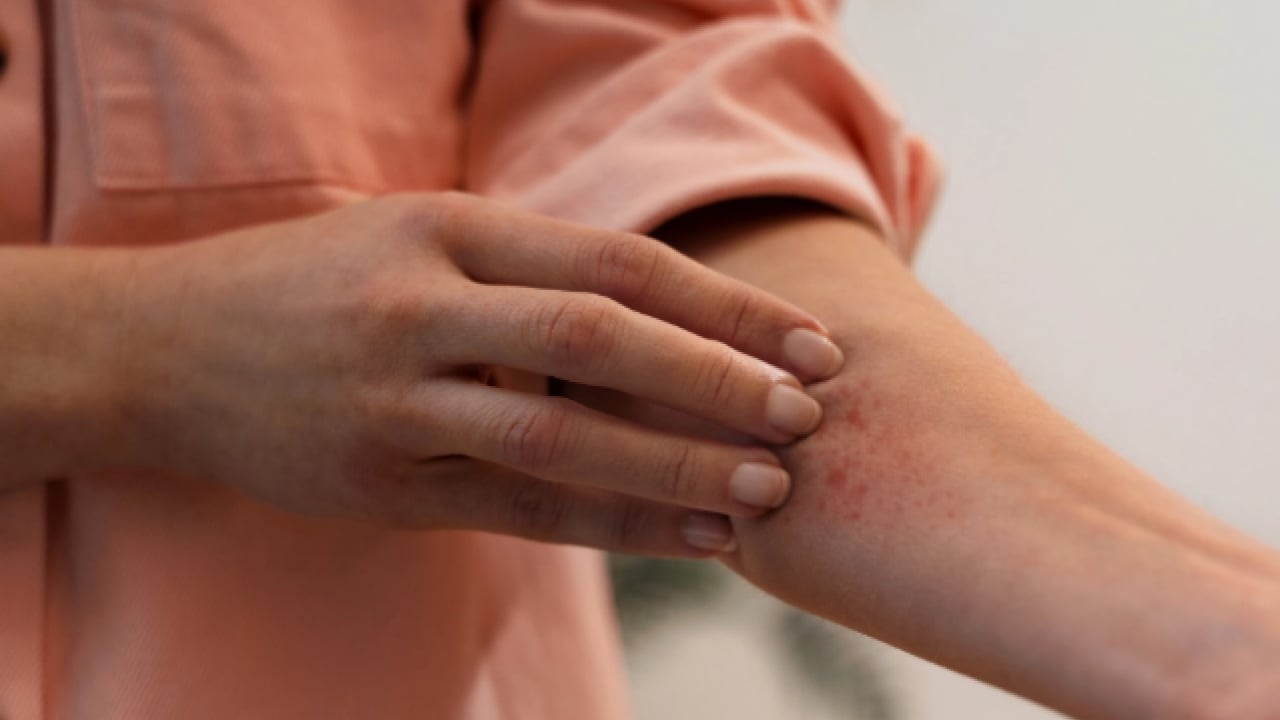 Foto - 40 yıl sonra ilk kez: 2 Avrupa ülkesinde görüldü!