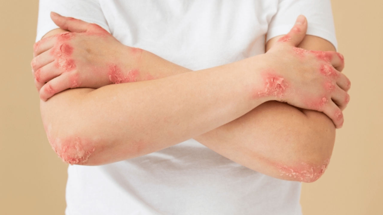 Foto - 40 yıl sonra ilk kez: 2 Avrupa ülkesinde görüldü!