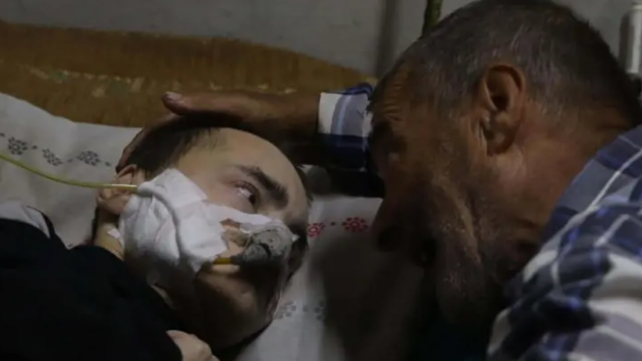 Foto - 40 yıldır oğluna bakan baba: Ben gittikten sonra ne olacak?