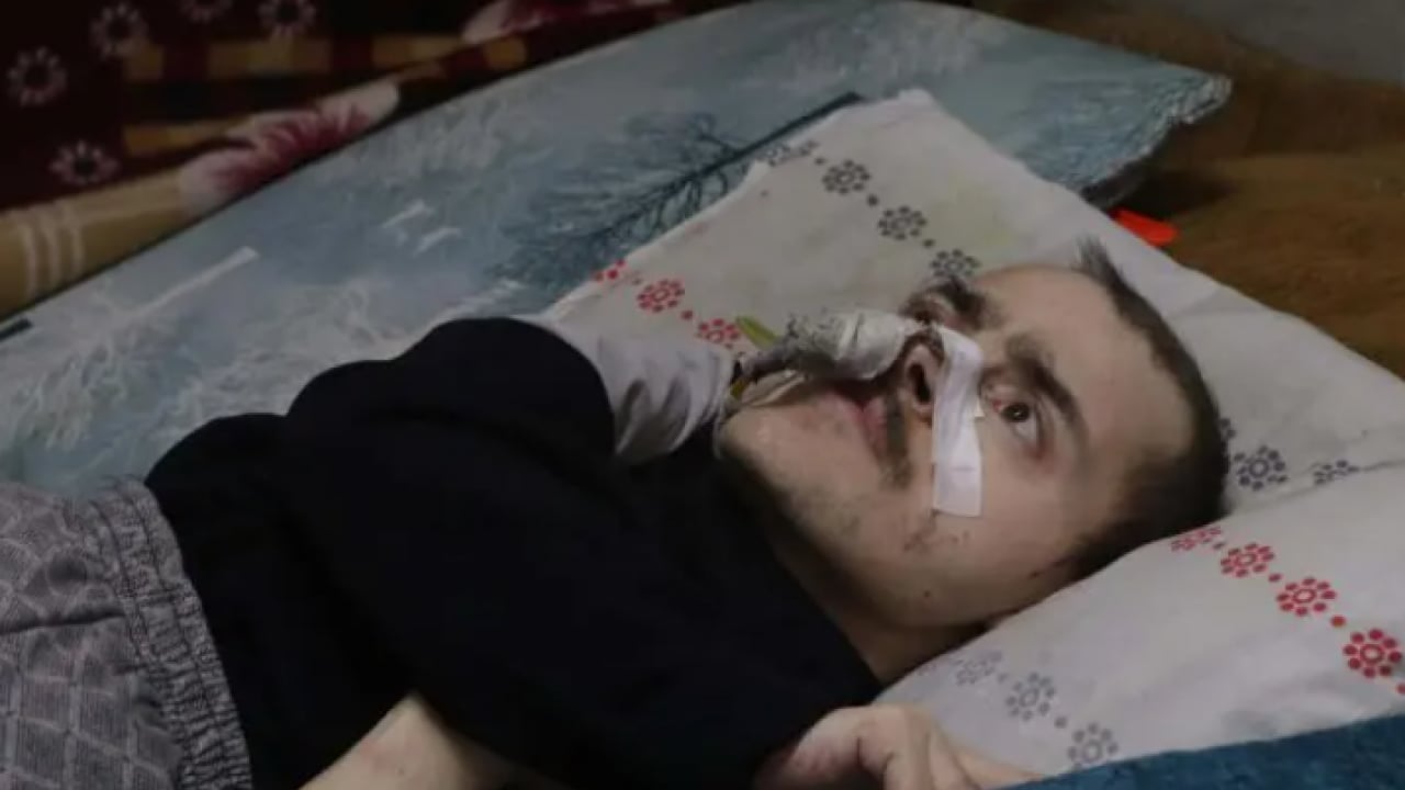 Foto - 40 yıldır oğluna bakan baba: Ben gittikten sonra ne olacak?