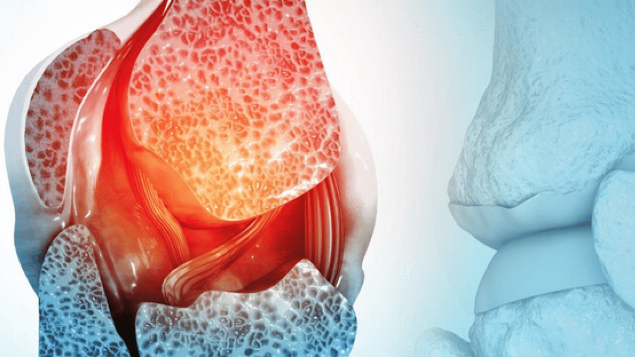 Foto - 5 bilim insanı bakın ne yaptı! Kemik erimesi tedavisinde yapay zeka destekli ilaç projesi