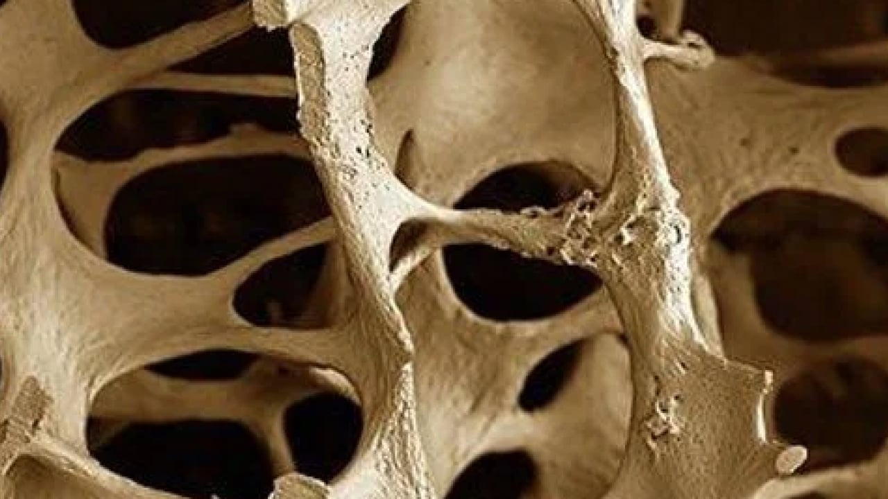 Foto - 5 bilim insanı bakın ne yaptı! Kemik erimesi tedavisinde yapay zeka destekli ilaç projesi