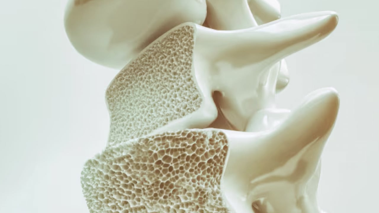 Foto - 5 bilim insanı bakın ne yaptı! Kemik erimesi tedavisinde yapay zeka destekli ilaç projesi