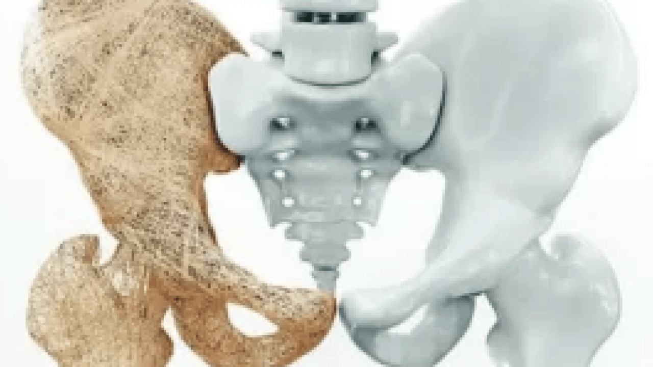 Foto - 5 bilim insanı bakın ne yaptı! Kemik erimesi tedavisinde yapay zeka destekli ilaç projesi