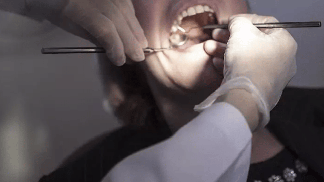 Foto - 5 yaşındaki çocuğun acı sonu: Diş yüzünden hayatını kaybetti!