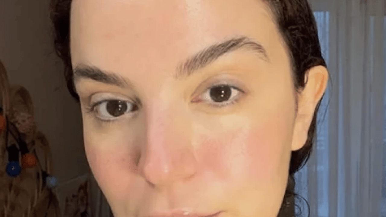 Foto - 7 kez ameliyat olmuştu: Aslı Bekiroğlu'ndan iyi haber!