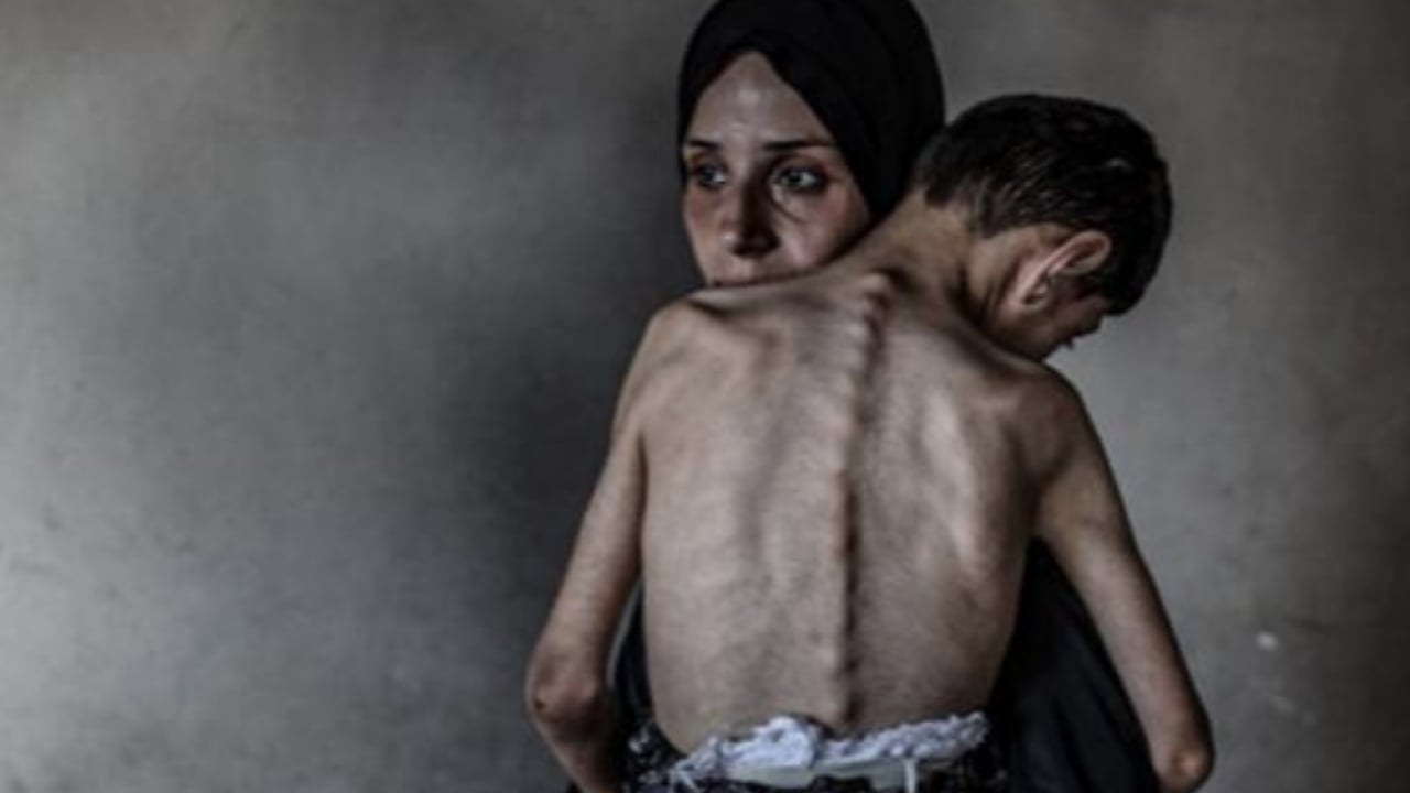 Foto - 72 binden fazla Filistinli şehid oldu... İsrail ablukası sürüyor: Gazze’de kıtlık artıyor