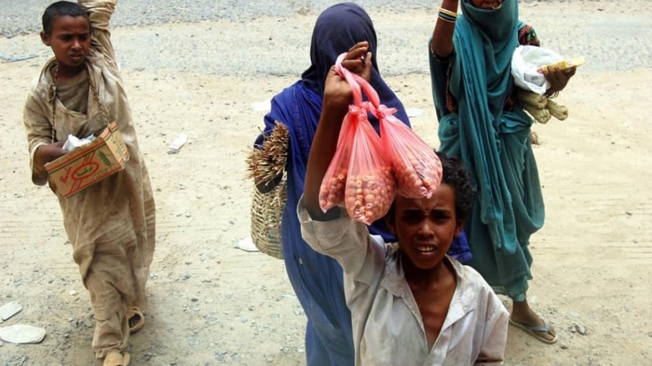 Foto - 7,8 milyon kişi açlık kriziyle karşı karşıya Dünya izlerken çocuklar can veriyor