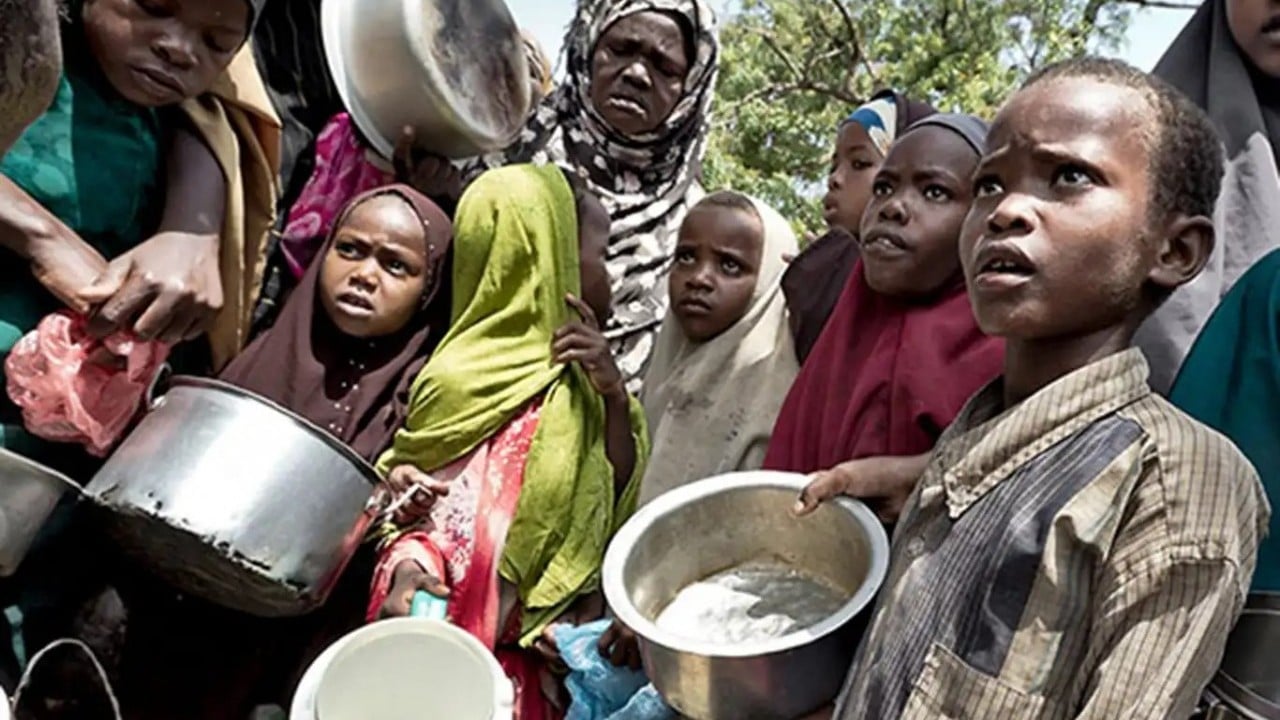 Foto - 7,8 milyon kişi açlık kriziyle karşı karşıya Dünya izlerken çocuklar can veriyor