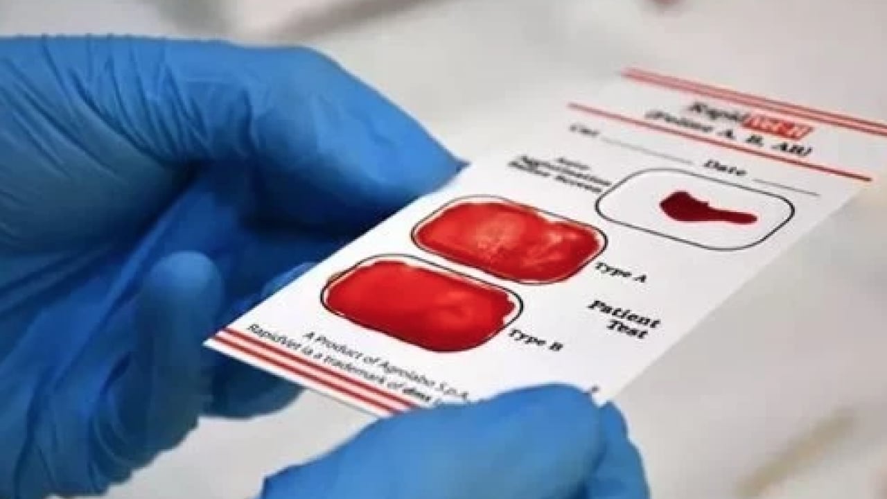 Foto - A Grubu mu, B mi, AB mi, O mı? Kan grubun karakterini açıklıyor