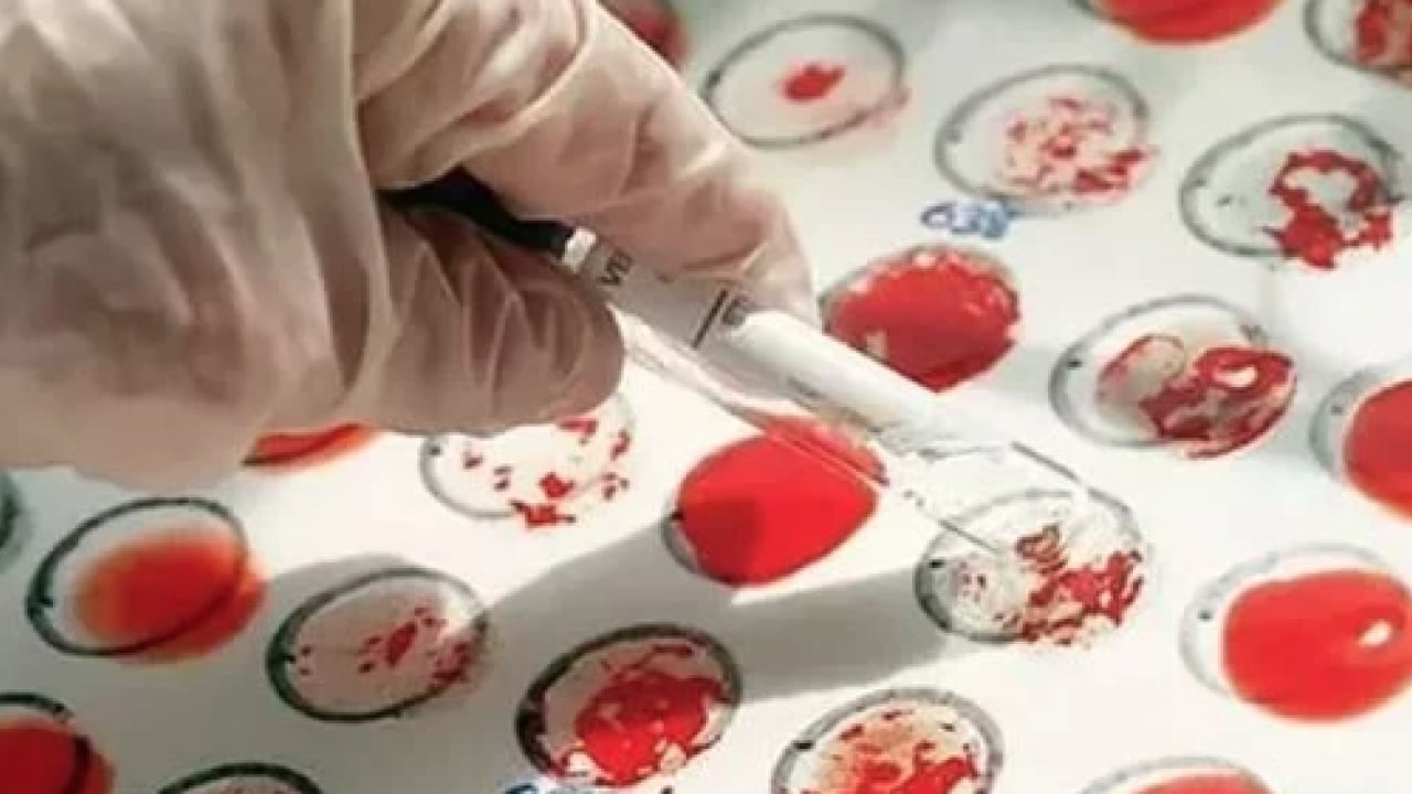 Foto - A Grubu mu, B mi, AB mi, O mı? Kan grubun karakterini açıklıyor